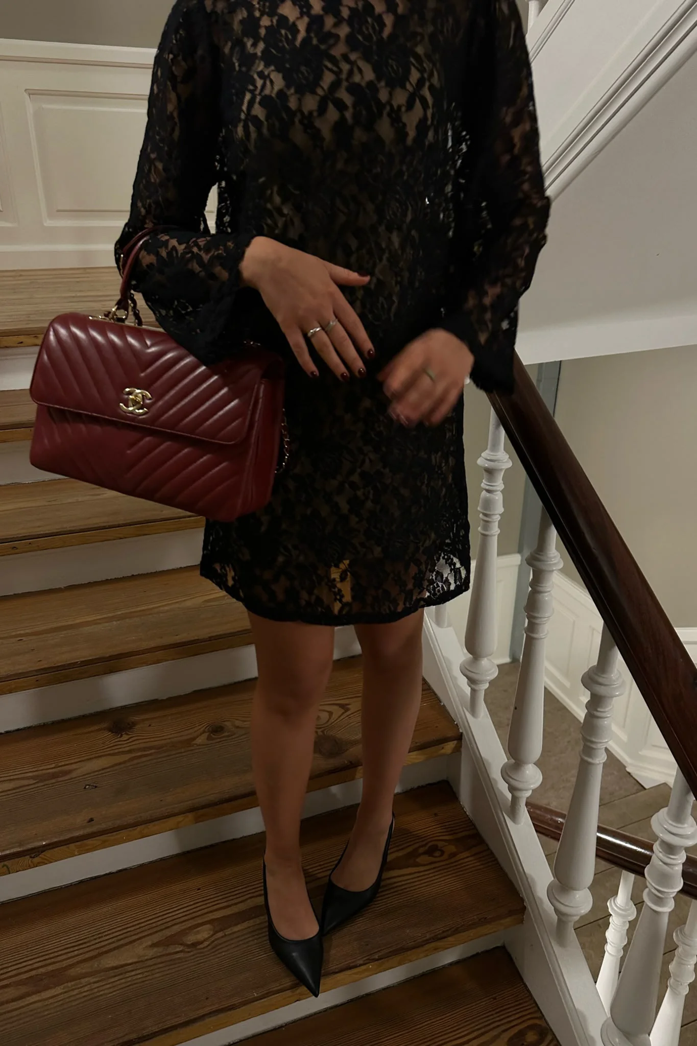 NeaIC Lace Dress - Black - Image 6
